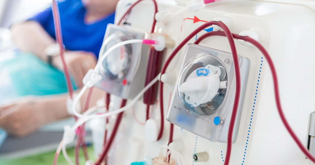 This Artificial Kidney Could One Day Eliminate The Need For Kidney Dialysis - Featured image