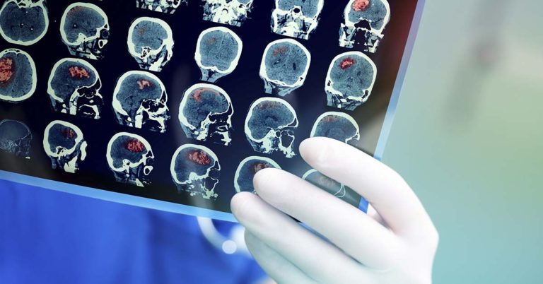 Boy Is The First To Be Cured Of A Deadly Brain Tumor - Featured image