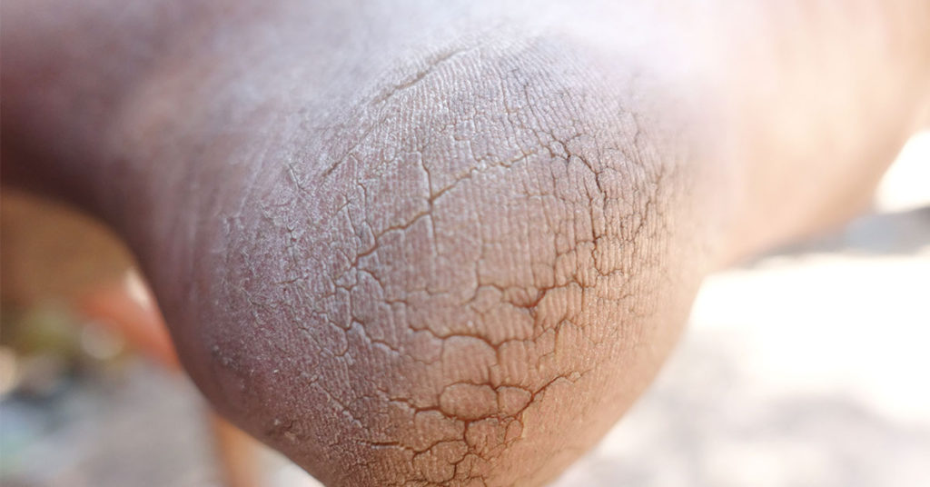 7 Simple Ways To Recognize Possible Body Issues - Featured image