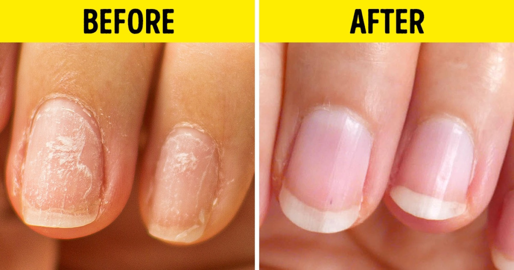 10 Home Hacks That Can Do Wonders for Your Nails - Featured image