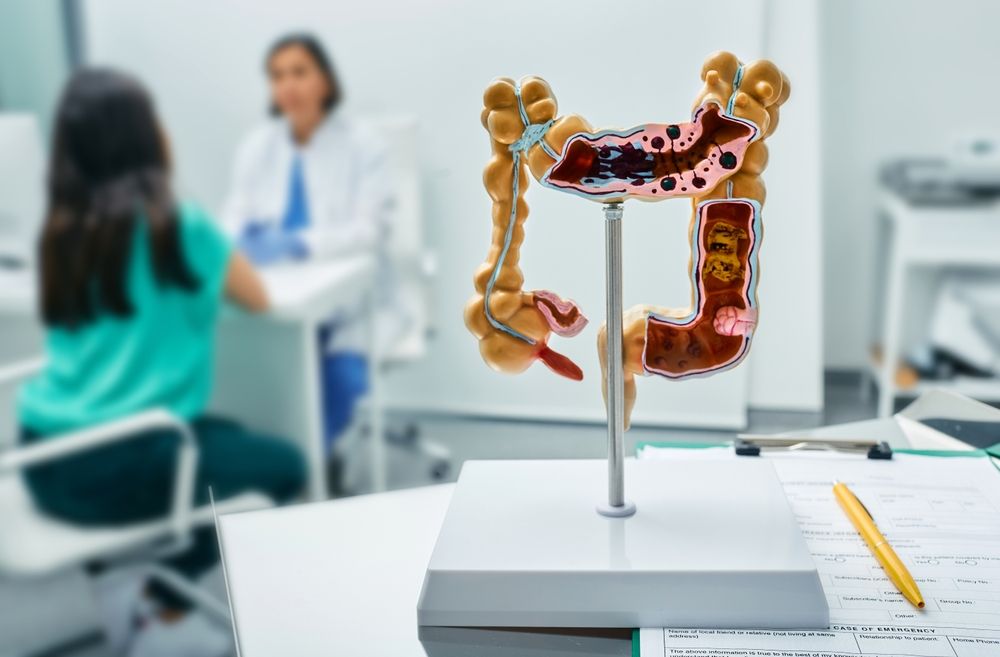 Gastroenterology consultation. Anatomical intestines model on doctor table over background gastroenterologist consulting female patient at medical clinic