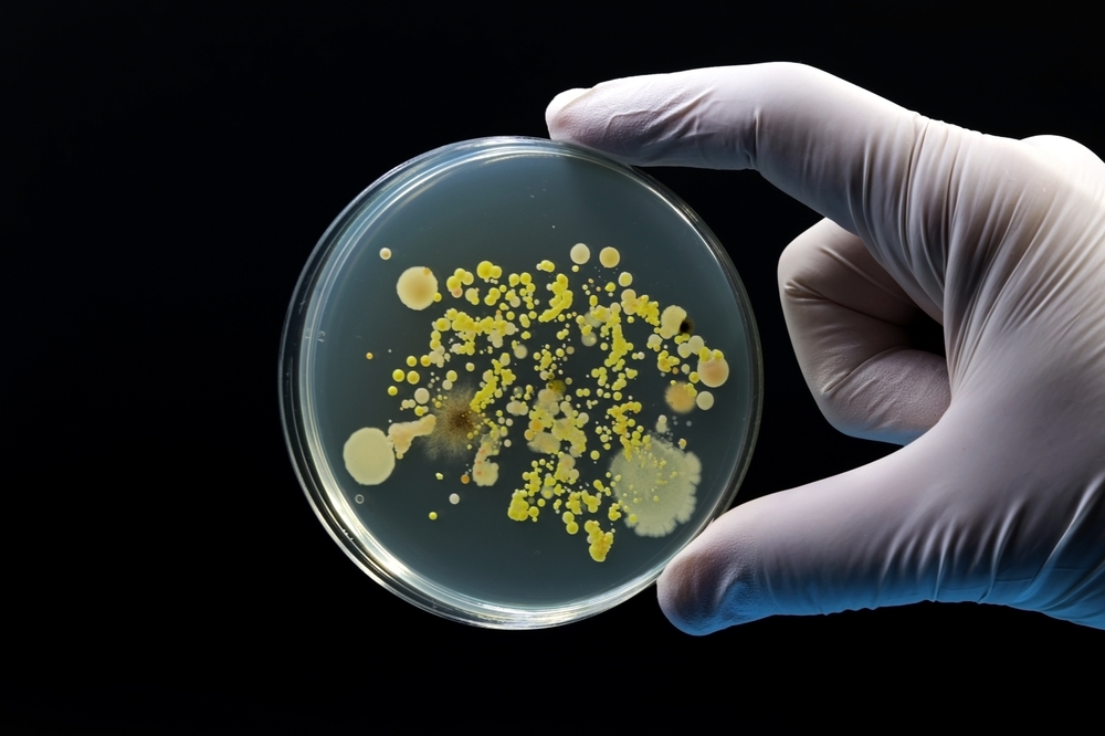 Doctor's or scientist's hand holding a microbiological culture Petri dish with different species of bacteria