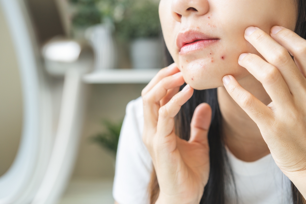 Expression worry asian young woman looking at mirror touching pustule around the chin and mouth, allergic when wear mask, spot scar from pimple on face. Beauty care, skin problem by acne treatment.