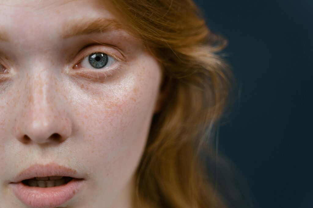 woman with freckales