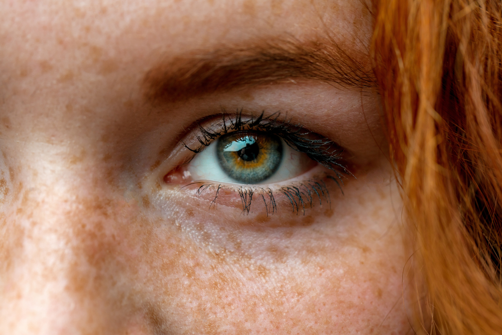Close up face of young red ginger freckled woman with ginger hair and perfect healthy freckled skin, wearing striped t-shirt, looking at camera with pretty cute smile