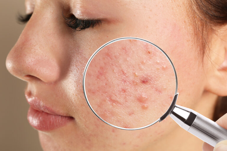 12 Skincare Products That Don’t Deliver & 12 Dermatologists Recommend - Featured image