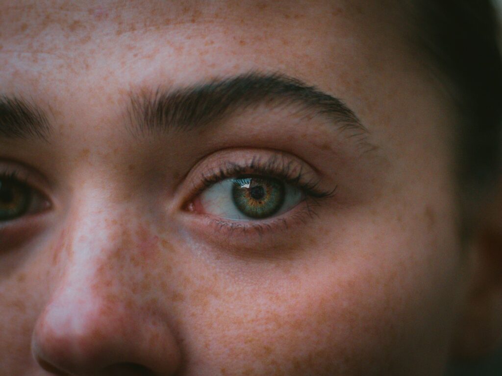 A close up of a person with freckled hair