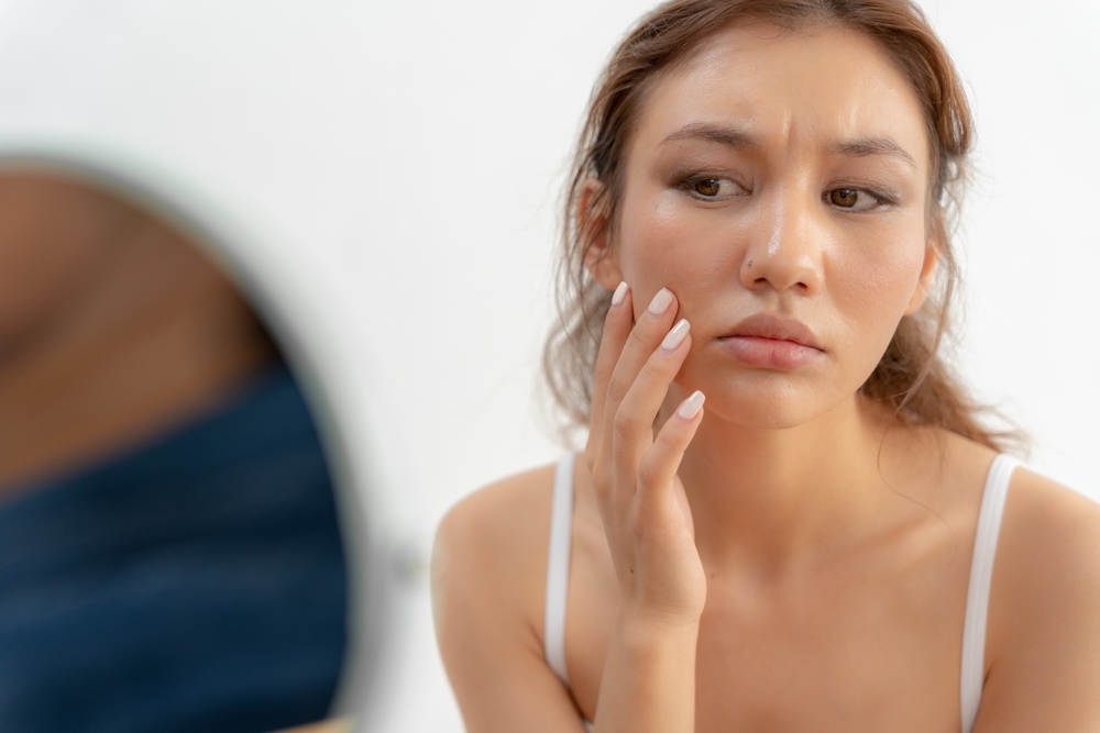 Woman worried about face Dermatology, rosacea dermatitis, allergic steroids, sensitive skin, red face from sunburn, acne, dry skin,large pores ,rash face, dull, freckles, wrinkle, skin problem, beauty