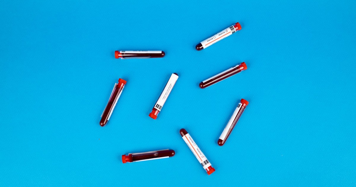 Multiple blood sample tubes arranged on a vivid blue background.