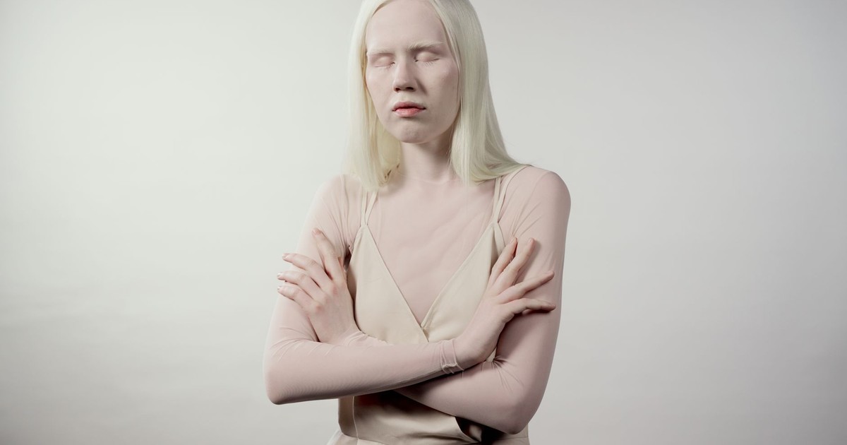 Striking portrait of a young albino woman with arms crossed against a light background, exuding serene confidence.